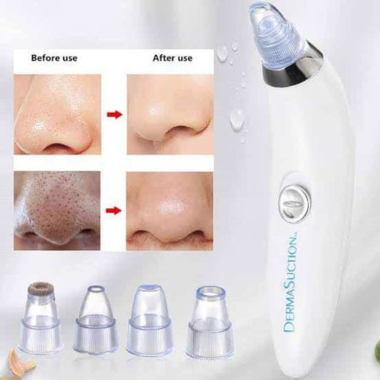 Blackhead Remover Vacuum Acne Cleaner Black Spots Removal